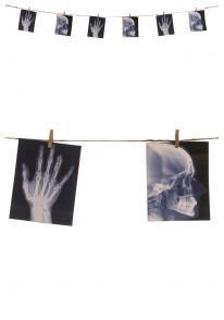 FILZA C/RADIOGRAFIE 160CM