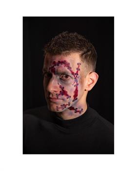 TATUAGGIO CICATRICI VISO