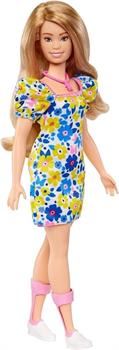 BARBIE FASHIONISTAS SINDROME DI DOWN